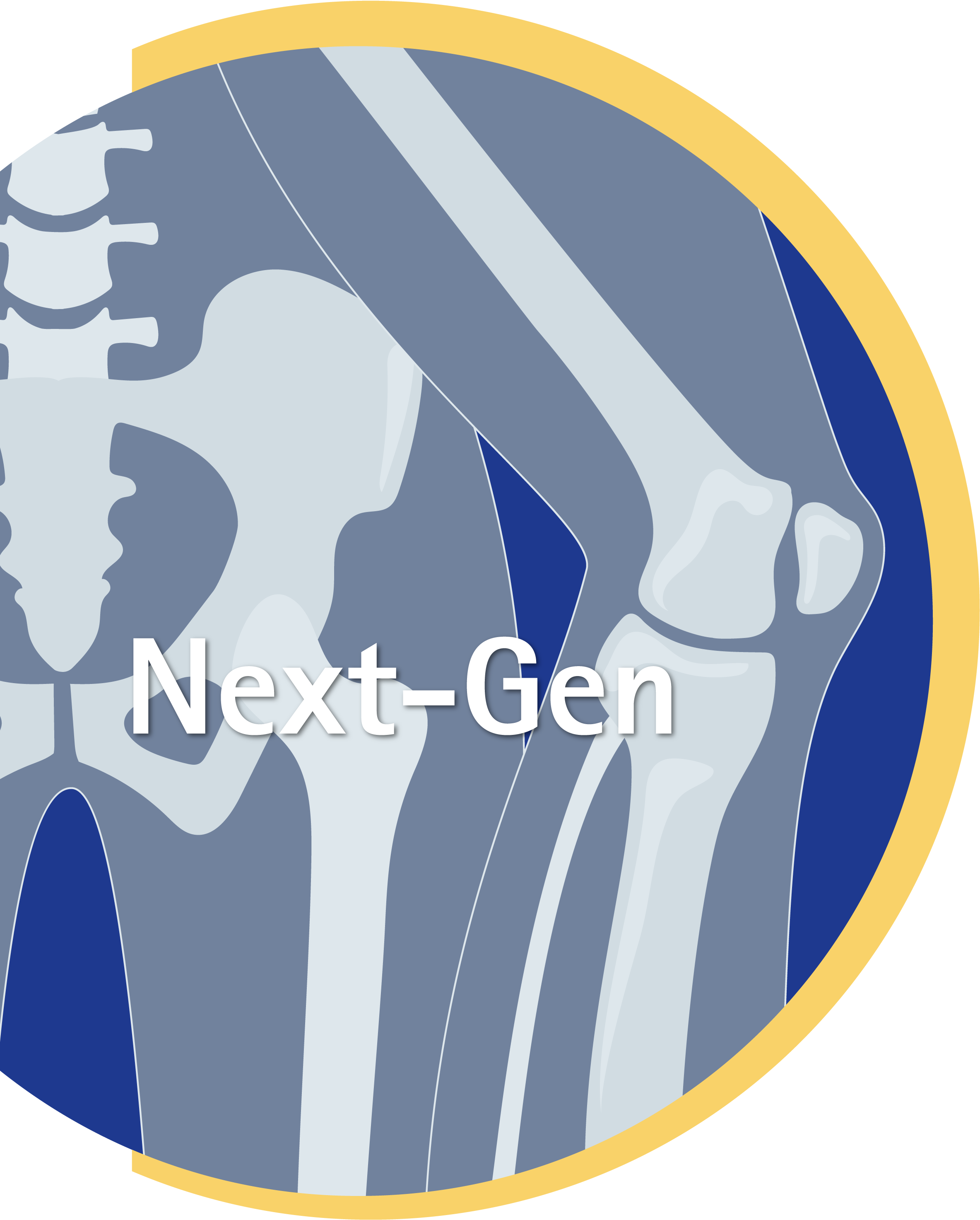 Next-Gen