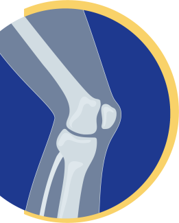 Gelenk Knie