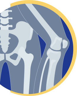 Hüfte und Knie